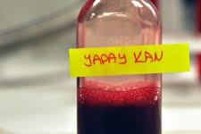 1 Yıl Sonra Yapay Kan Damarlarımızda!