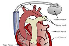 Kalp Ameliyatları Ücretli Olacak
