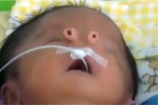 Dünyanın Sıra Dışı Burunu!